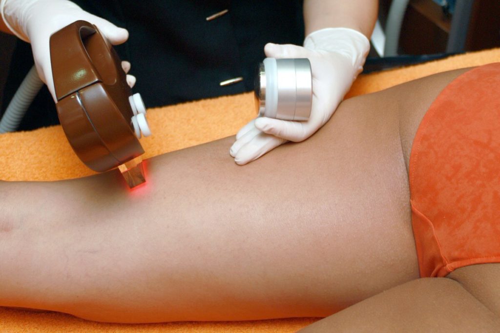 Luxe Laser Hair Removal Services