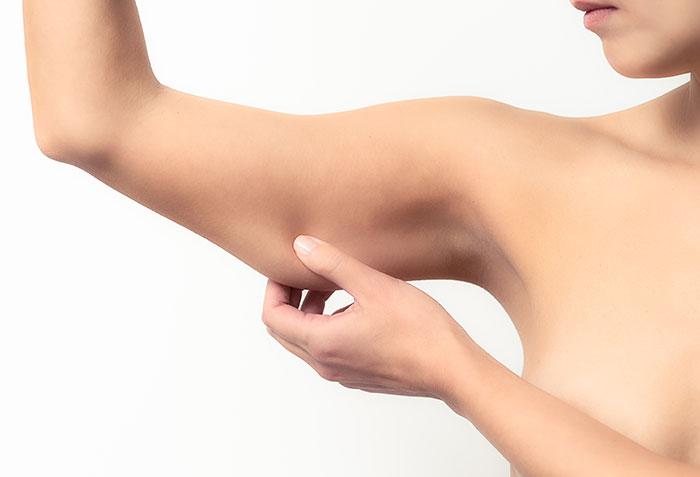 CoolSculpting for Arms